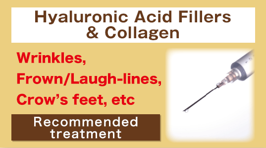 ヒアルロン酸、コラーゲン注入 ほうれい線や表情しわに